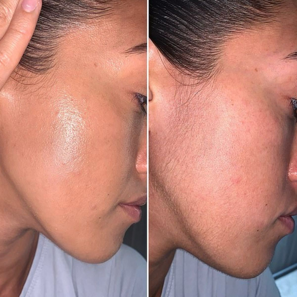 Face/Chin Waxing