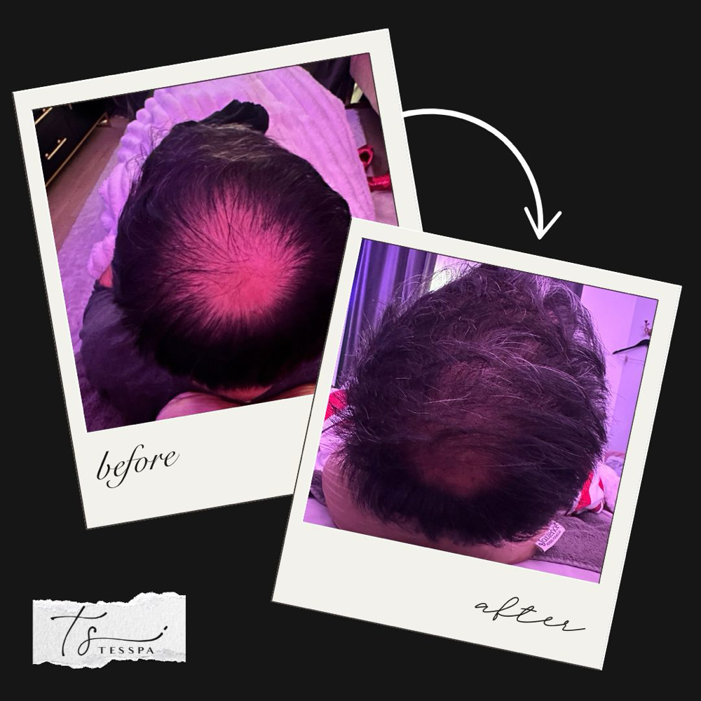 Hair Renewal Series at TesSpa in Issaquah, WA