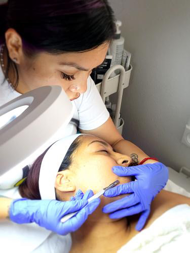 Dermaplaning