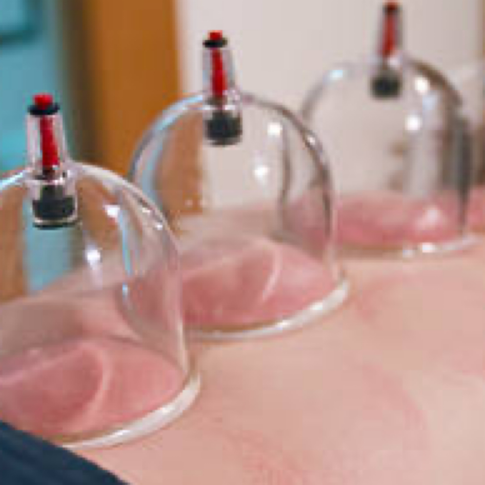 Cupping Therapy at Glo Body Co. in Trenton, MO