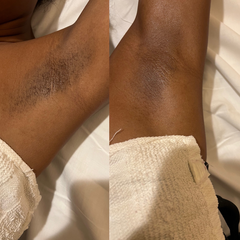 Under Arm Wax