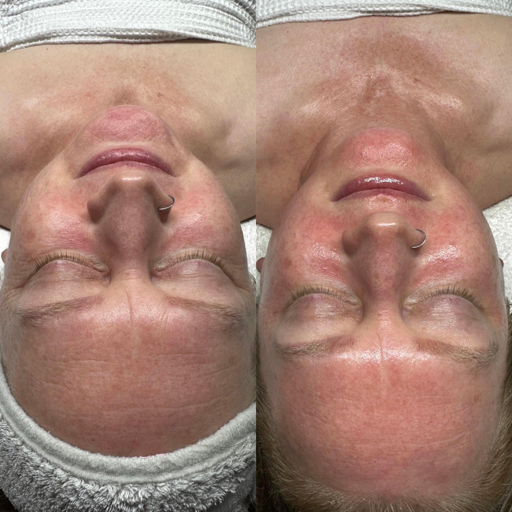 Clinical Treatments