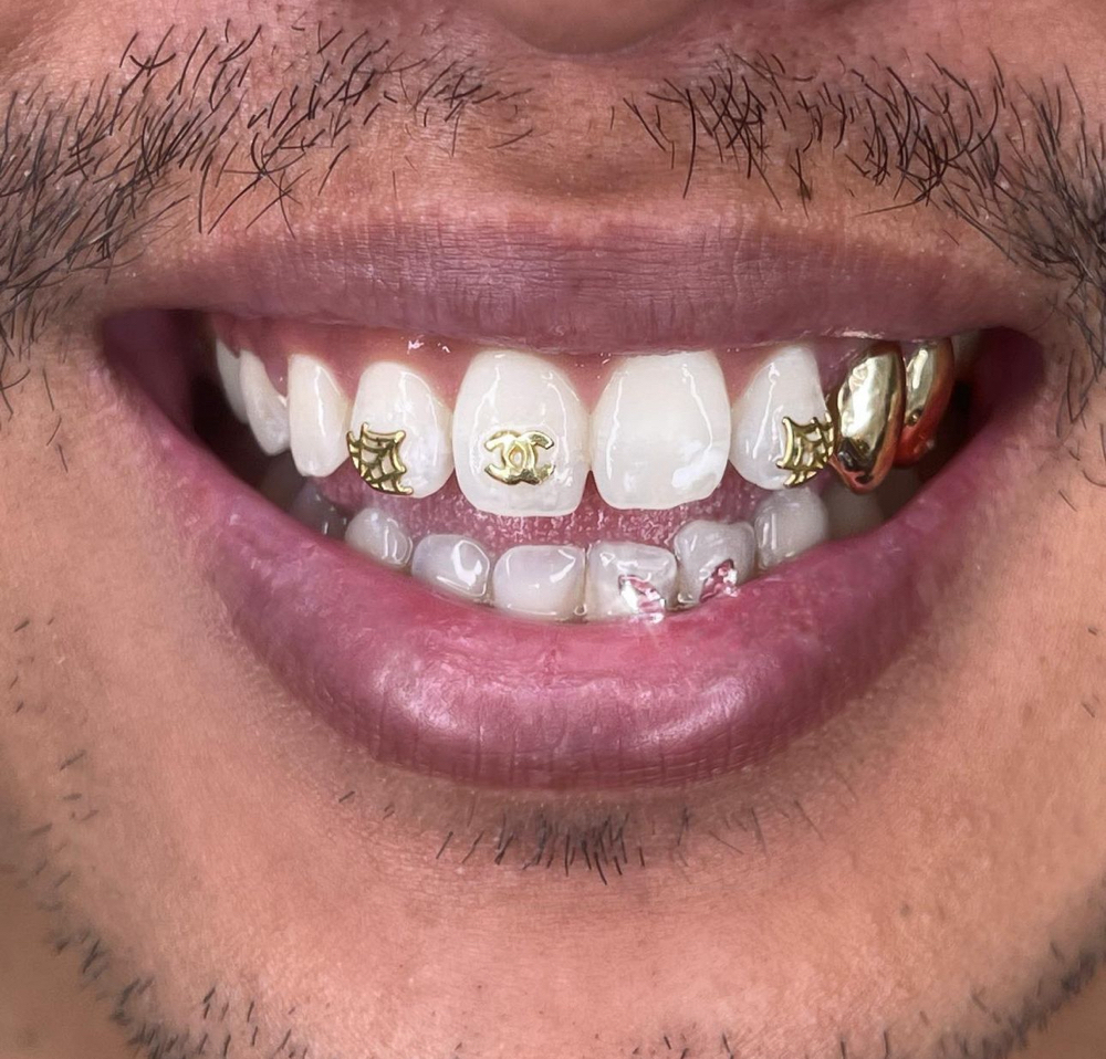 Gold Tooth Gem