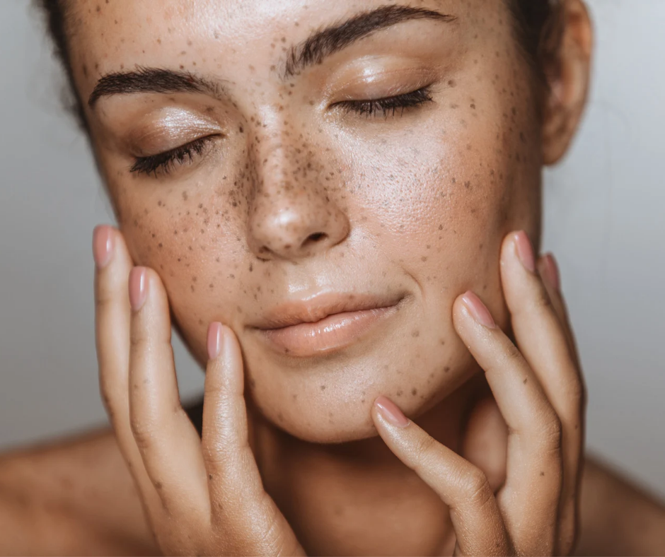 Laser Consultation - Skin