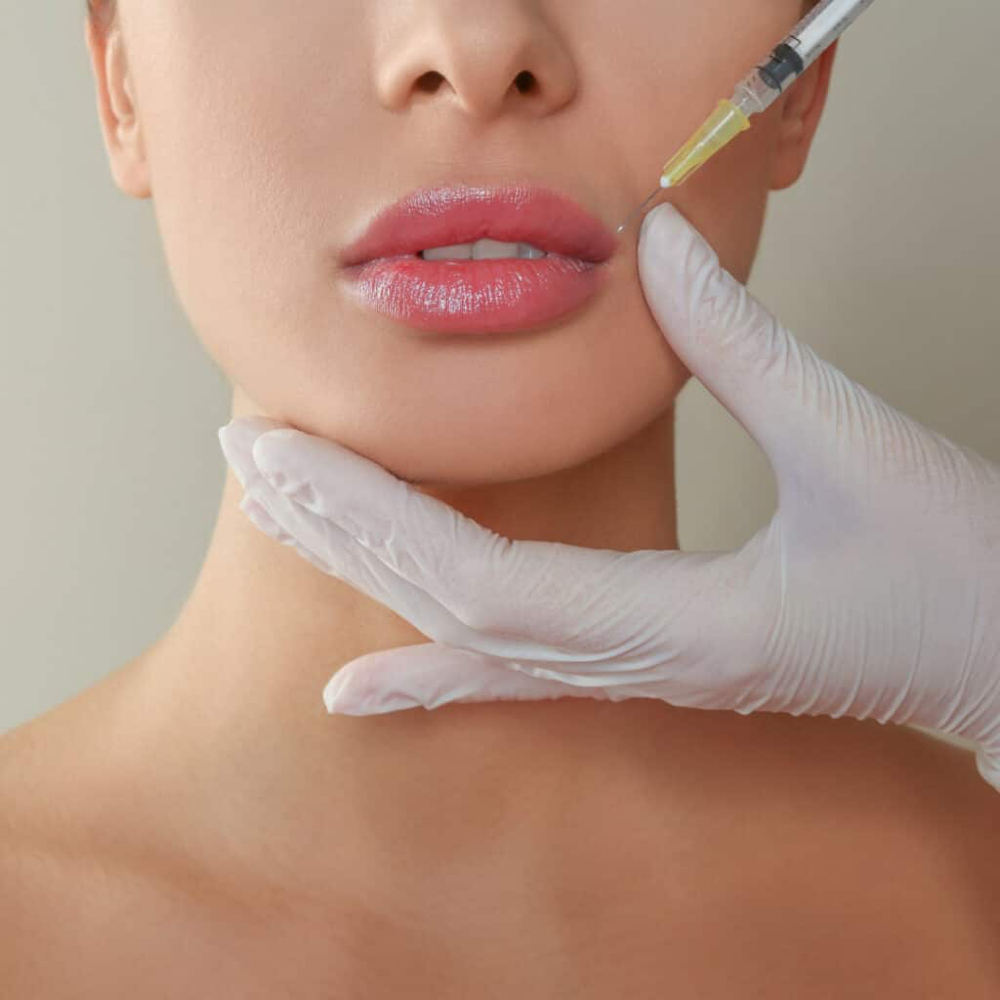 Dermal Filler Dissolve