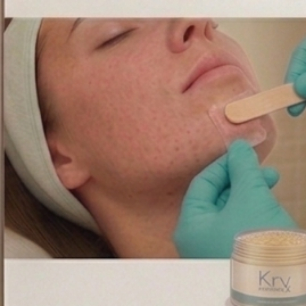 Chin It To Win It at Pore Decisions Esthetics LLC in Hinesville, GA