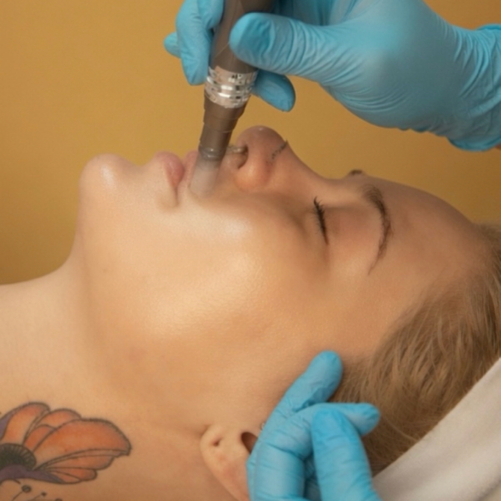 The Nano Infusion Facial at Altitude Skin Studio in Denver, CO