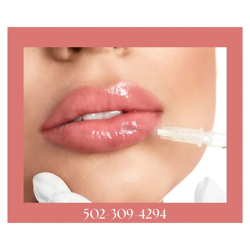 Dermal Filler
