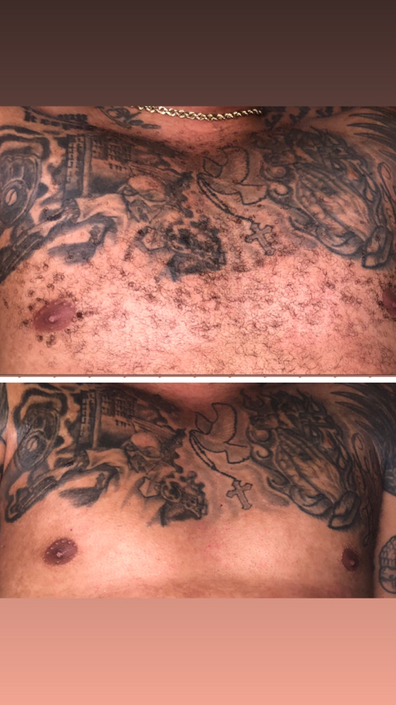 Chest Wax - Men