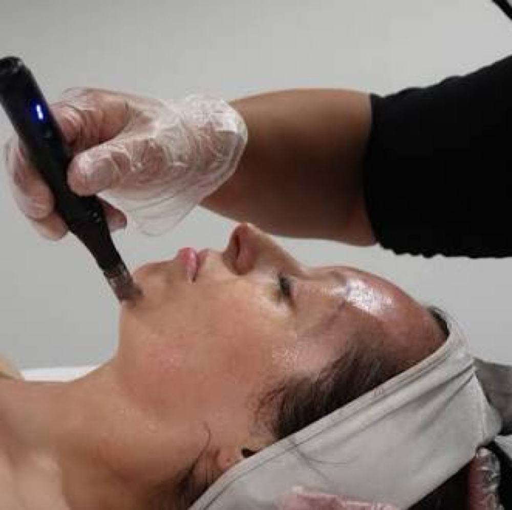 Microneedle W/ PDRN Salmon DNA at Studios Secrets in Dallas, TX