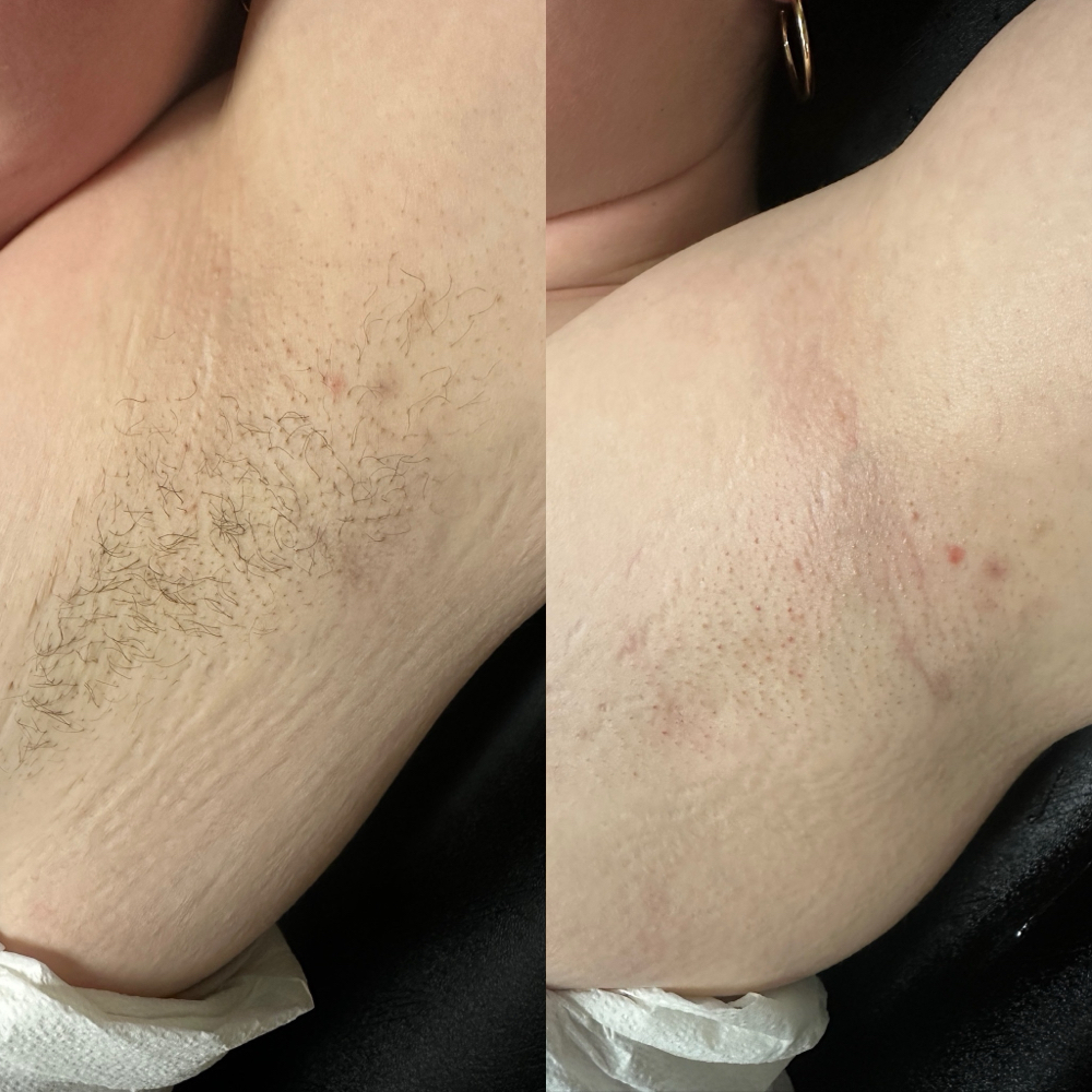 Underarm Wax