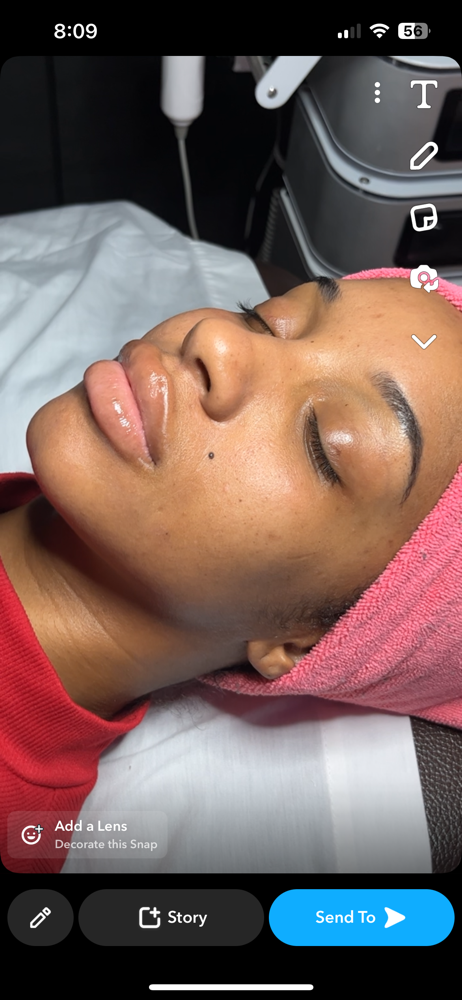 Chemical Exfoliation Peel:(Level 1)