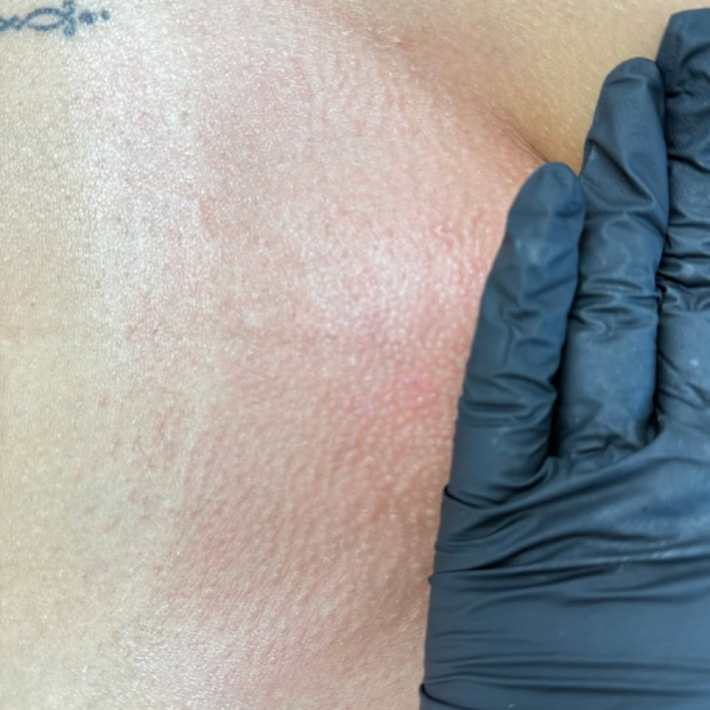 Brazilian at Ama Aesthetics Studio in Methuen, MA