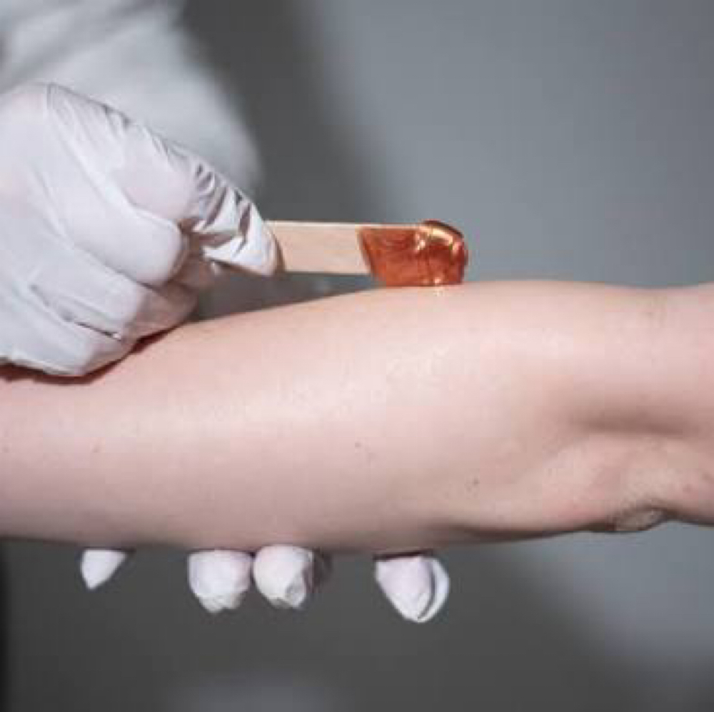 Arms (Full) at Sapphire Aesthetics, LLC in Monterey, CA