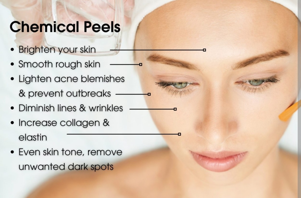 Chemical Peel