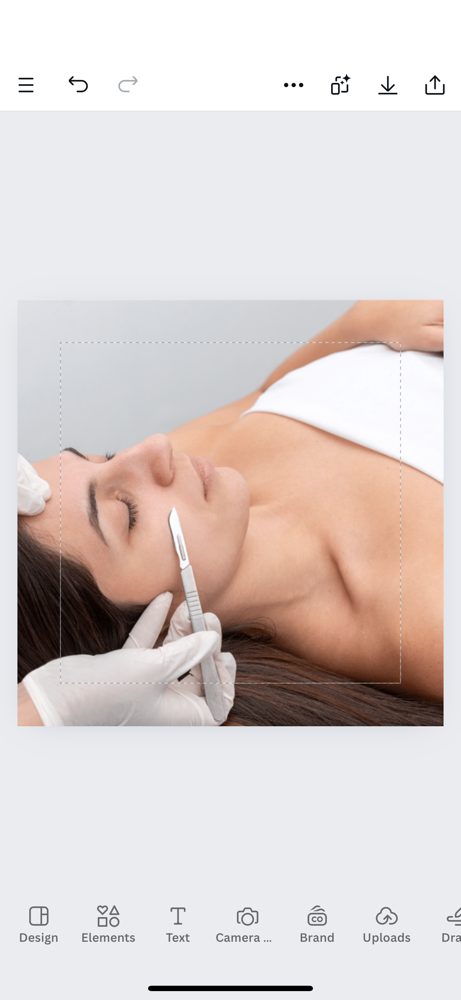 DERMAPLANING