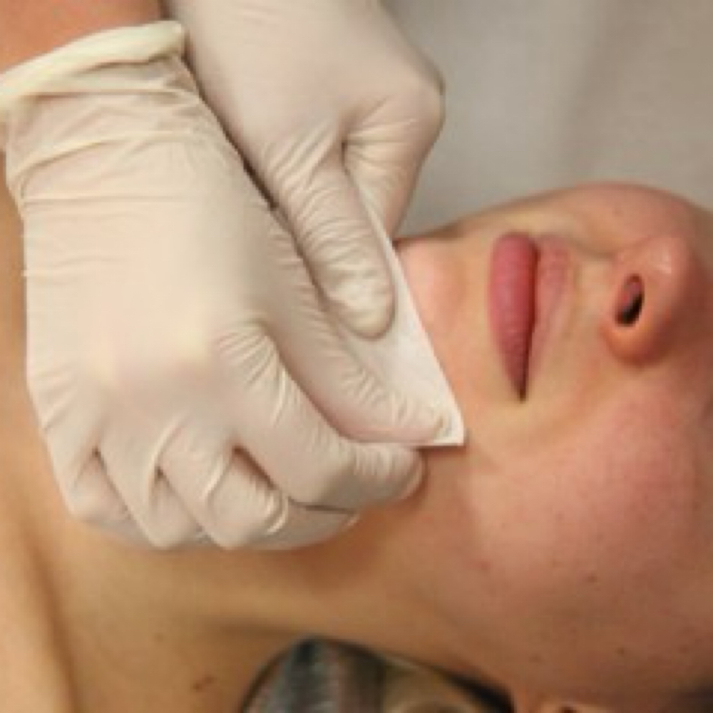 Chin Wax at Sol Esthetics in Chicago, IL