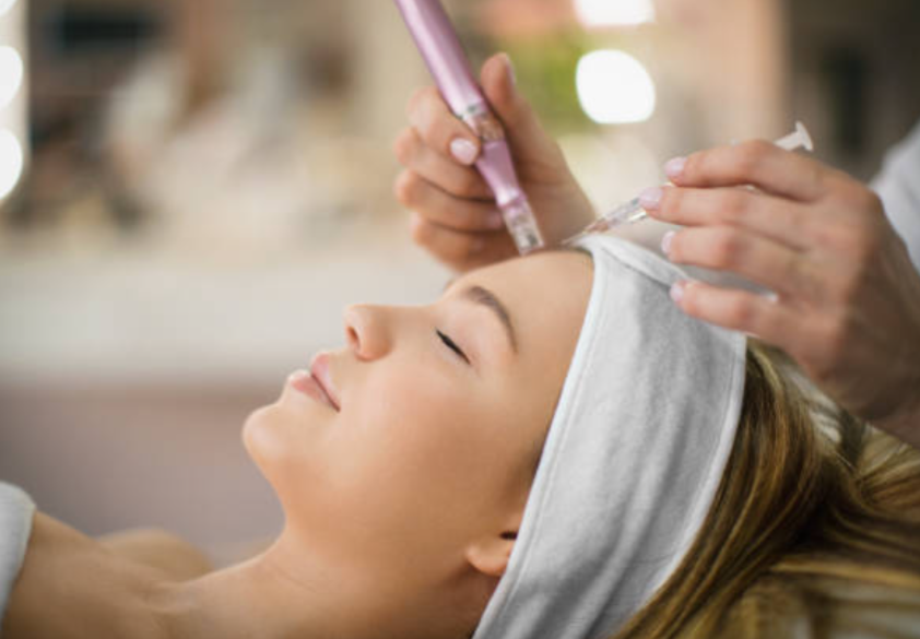 Vitamin C Microneedling Facial
