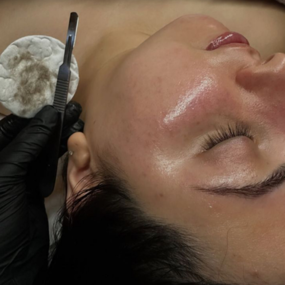 Dermaplaning at VELVIQ SKN in Albuquerque, NM