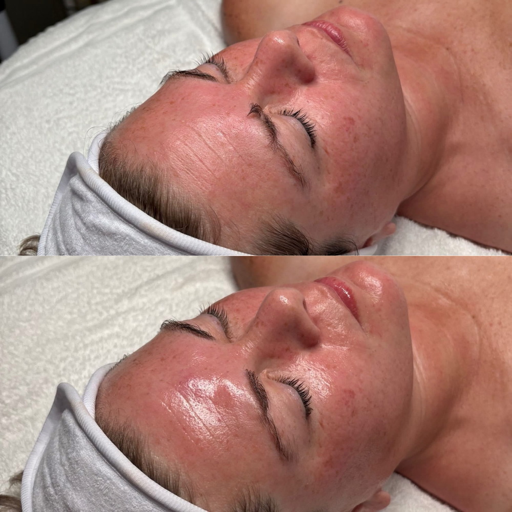 Brightening Facial at Farah Elexis Billiot in Houma, LA