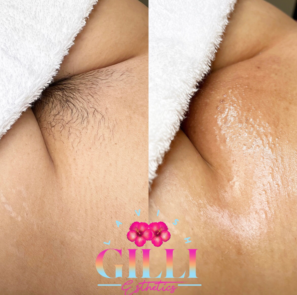 4-6 WK Brazilian Wax (F.A)