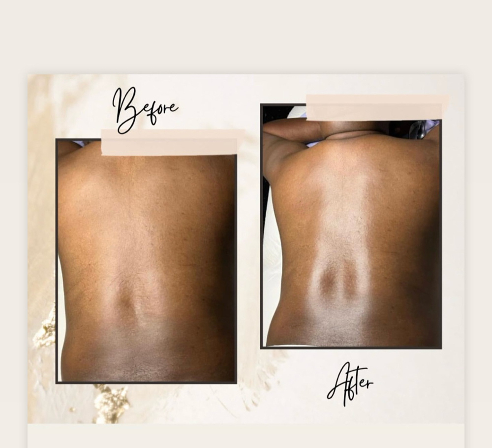 Bacial (Back Facial) at Glam’d By Tierra Maenise in Kelford, NC