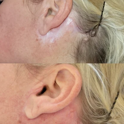 Scar Camouflage at GloVolution LLC in Homosassa, FL