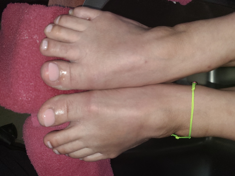 Big Toe Acrylic