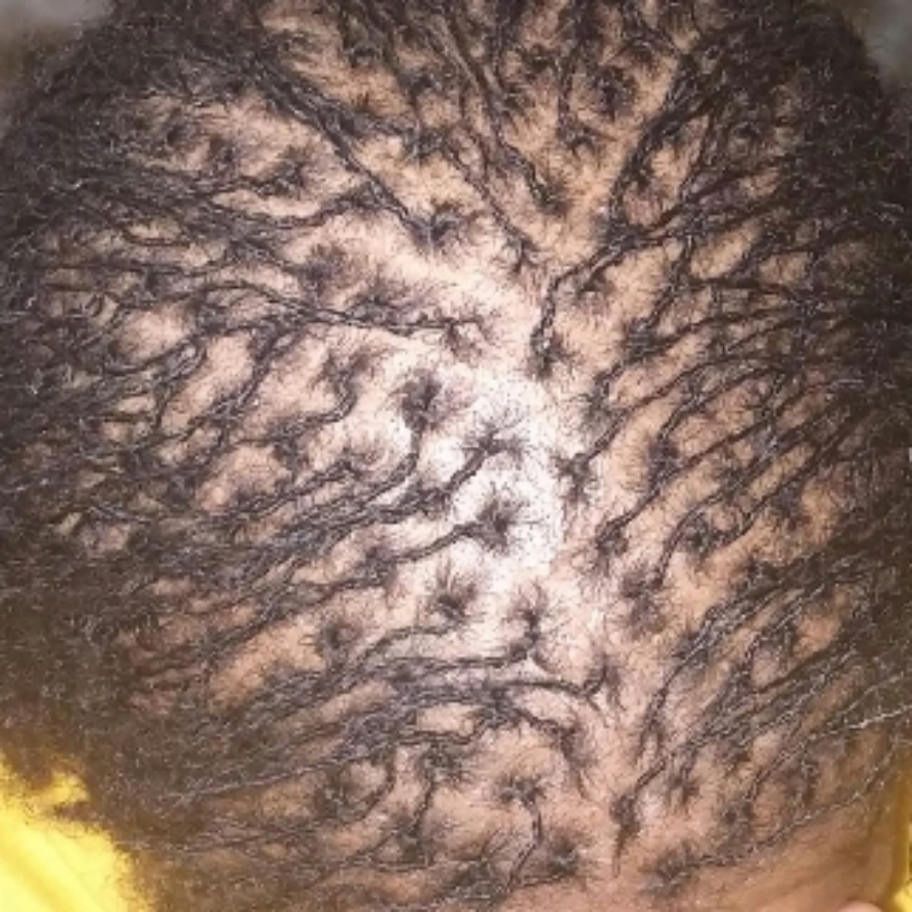 Starter Locs - Interlock at Twistykinks & Twist of Elegance Esthetics in Jacksonville, AR