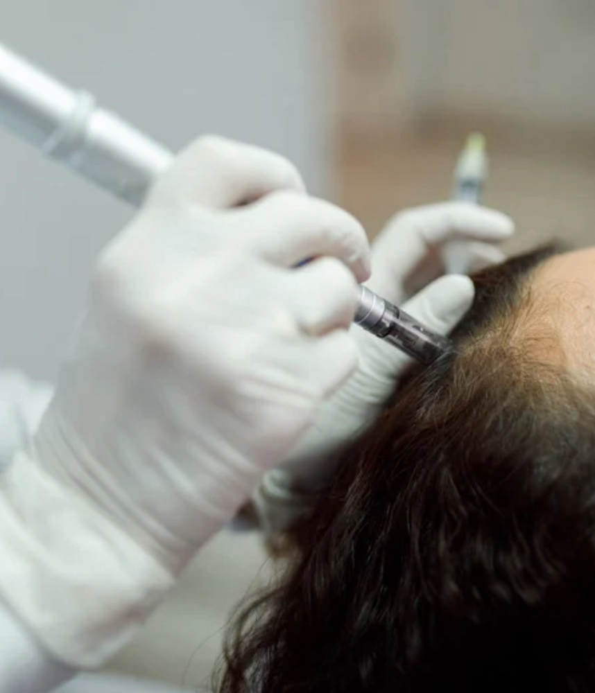 Hair And Scalp Restoration Therapy