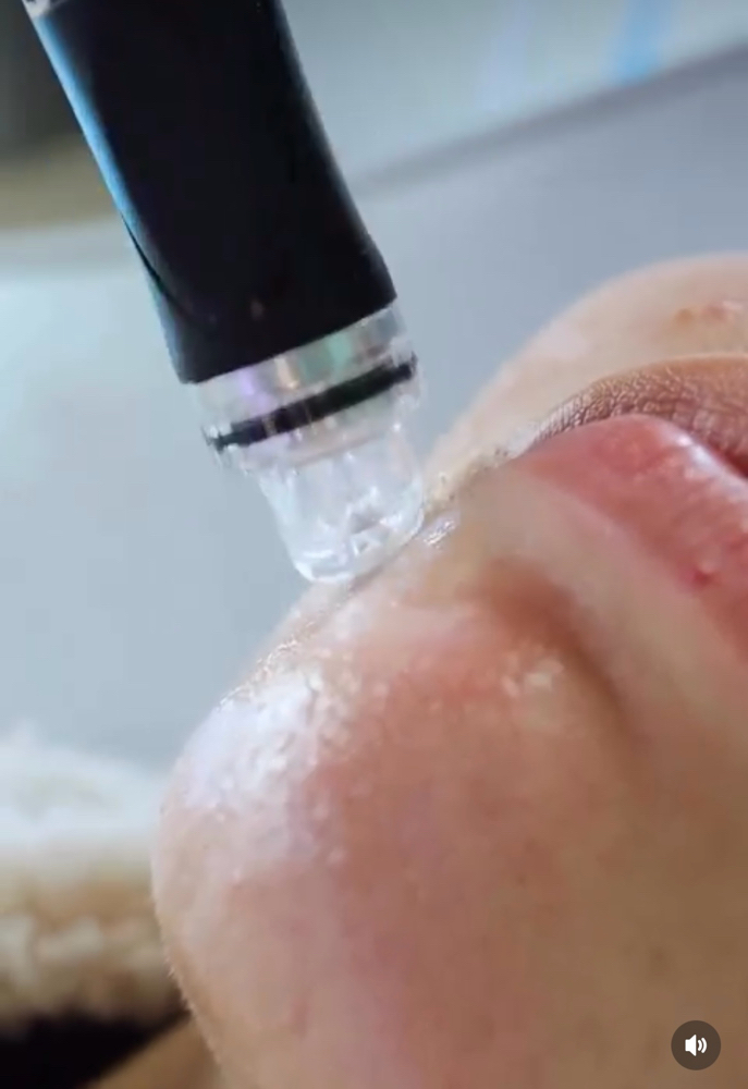 Brightening Hydrafacial