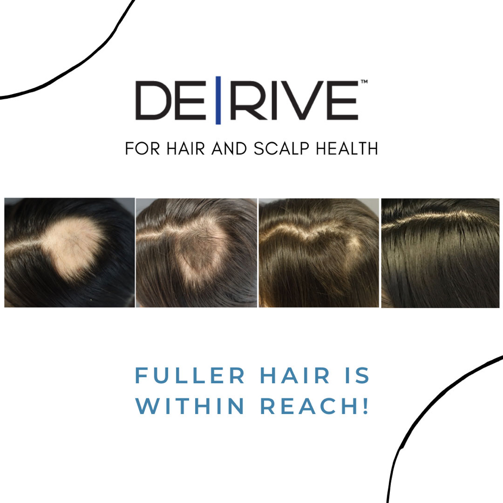 Derive Exosome Stem Cell Treatment at In The Chair With Tiffany in Indian Wells, CA