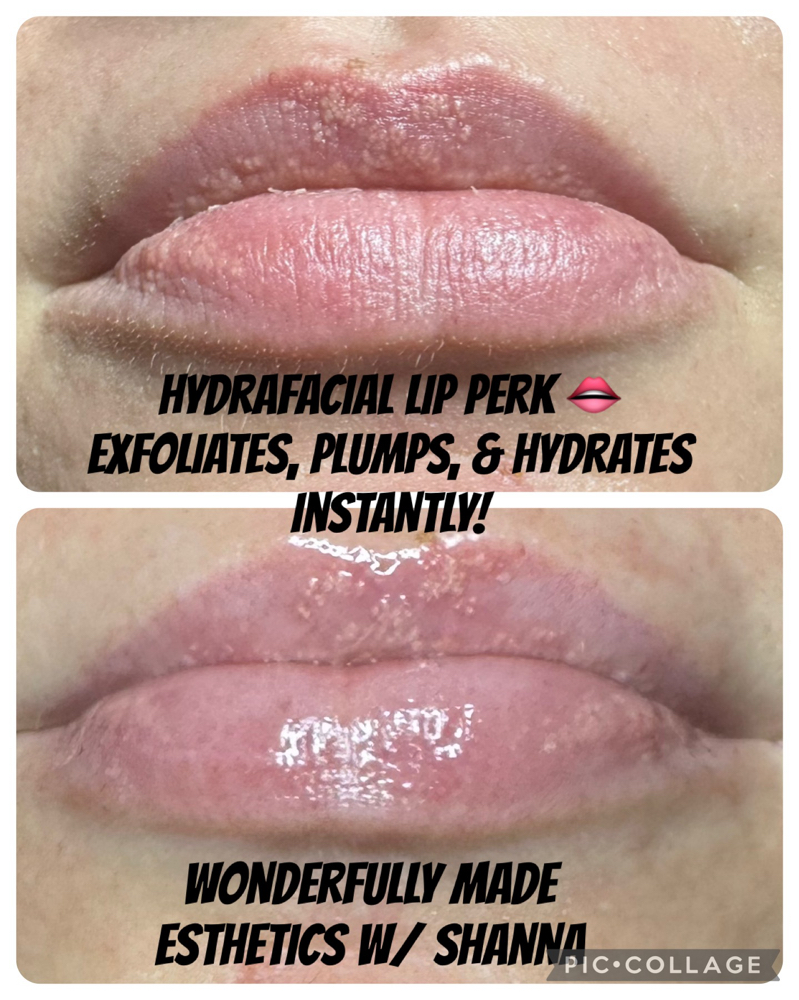 Lip Perk