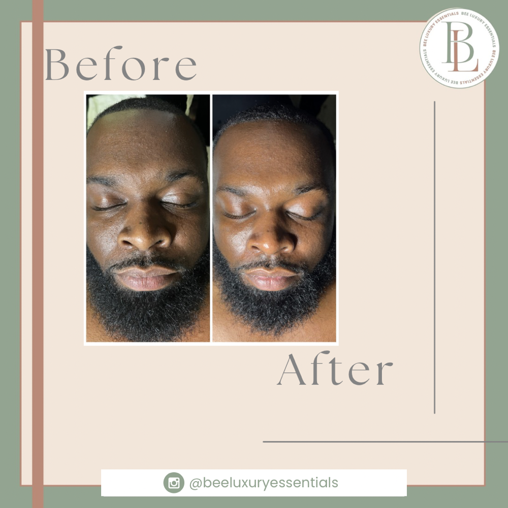 Welcome Client Facial