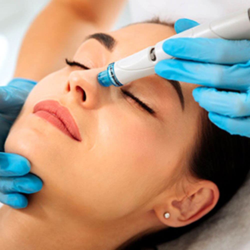 Hydro Dermabrasion Facial at Radiant Veil Skin Studio in El Paso, TX