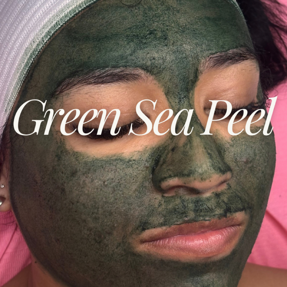Green Sea Peel 🌿 at Luv U Aesthetics in Goodyear, AZ