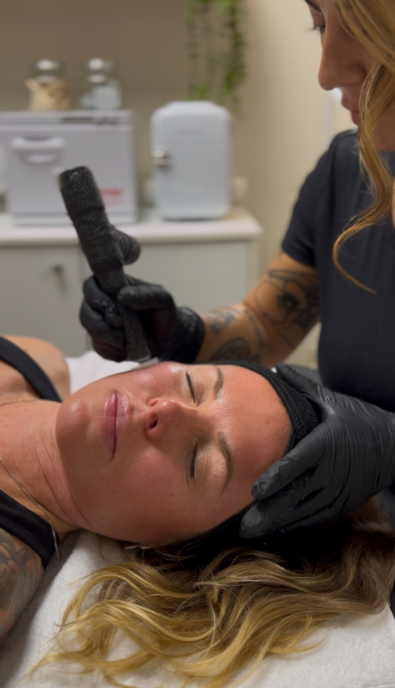 Microchanneling ✨ The Cult Classic at The Collagen Cult in San Diego, CA