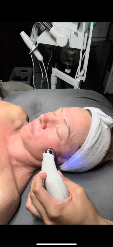 NuFace Add-On