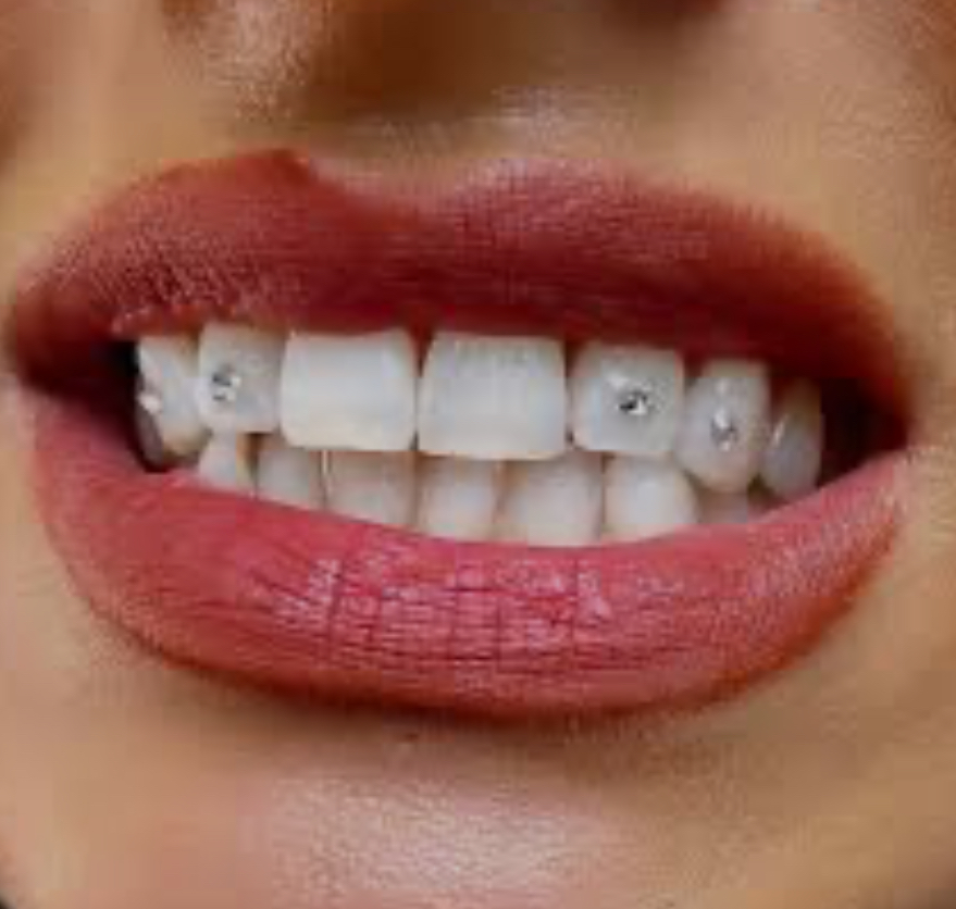 Tooth Gem Full (4 on top 4 on bott)