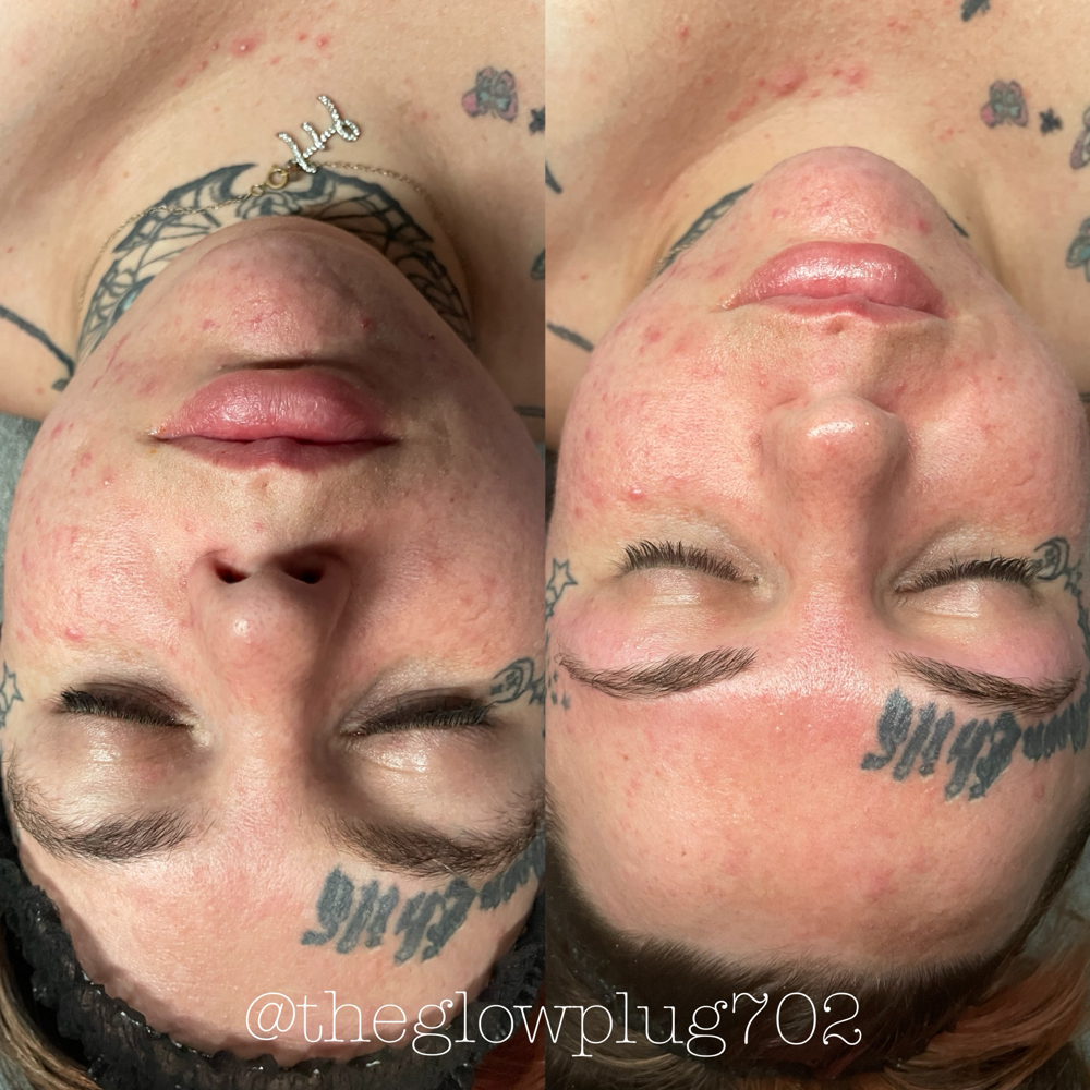 Customizable Glow-60 Min Facial