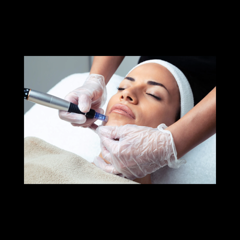 Hydrodermabrasion Facial