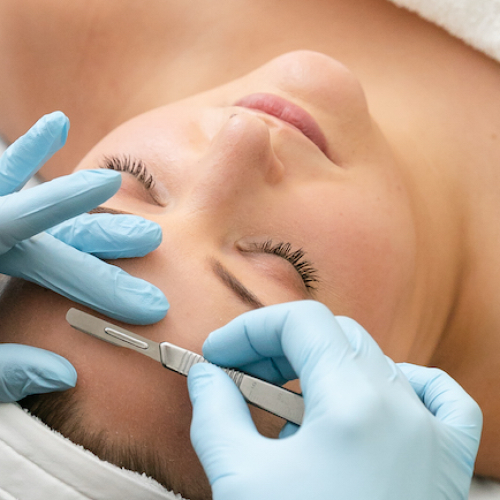 Dermaplaning at Moonglow Skin Studio in San Jose, CA
