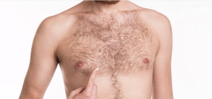 Chest