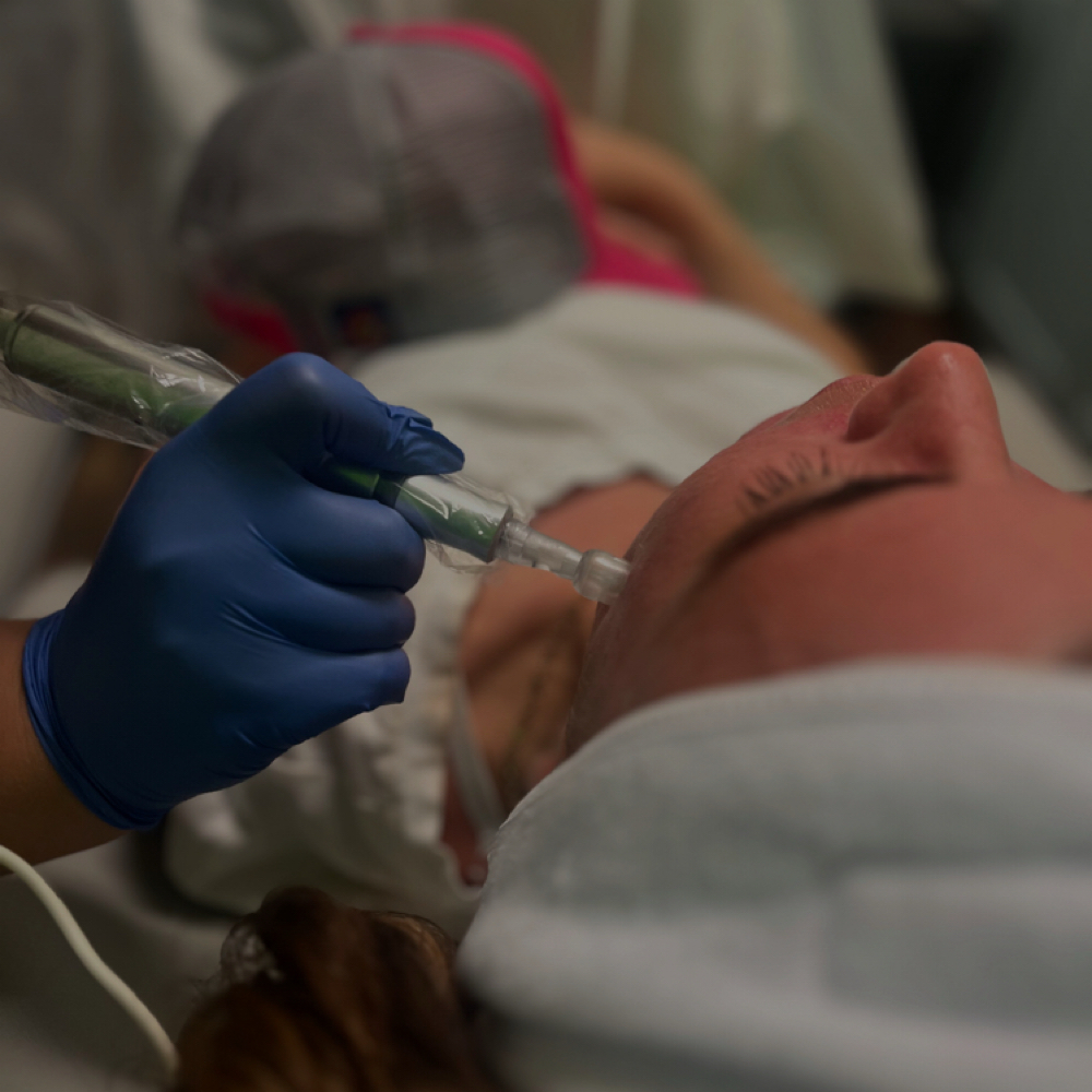 Microneedling at Genesis Health and Beauty Bar in Daphne, AL