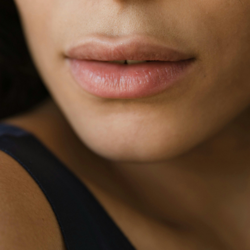 Upper lip at Anew Luxury in carson, CA