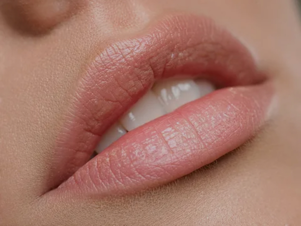 Full Lip Treatment