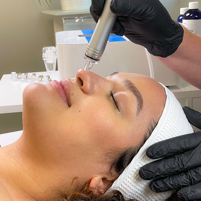 Hydradermabrasion facial treatment