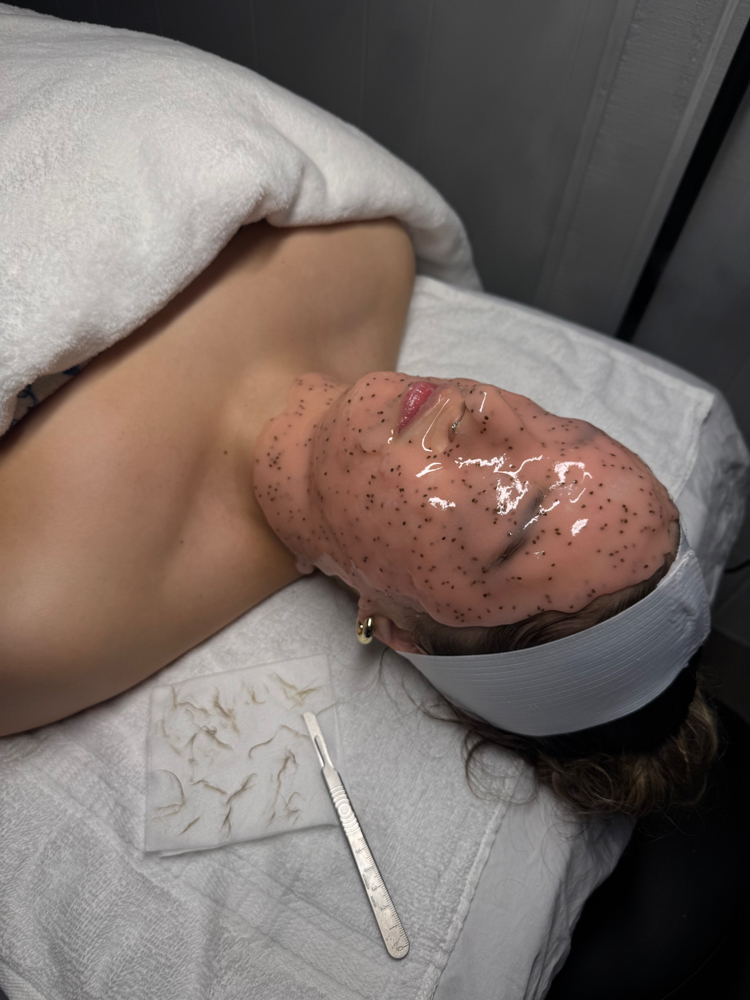 Luxury Dermaplane