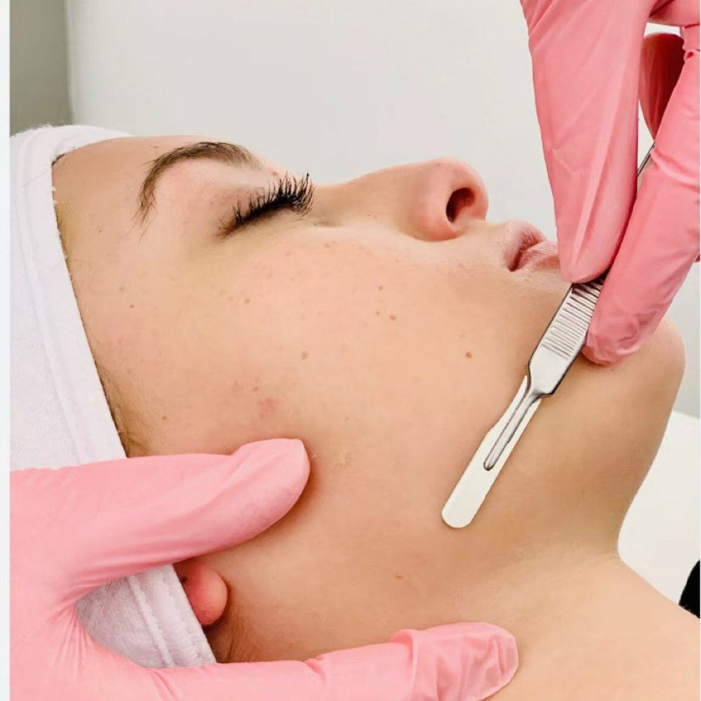 Dermaplaning Treatment