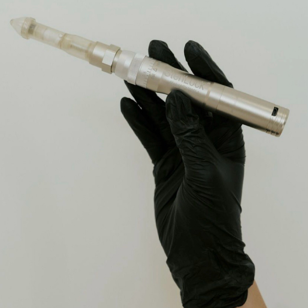 MARCH SPECIAL Nanoneedling Add On at Caroline Ply Esthetics in Little Rock, AR